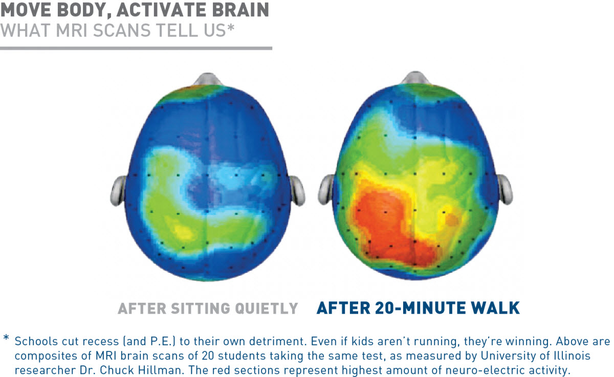 MRI Brain Scans